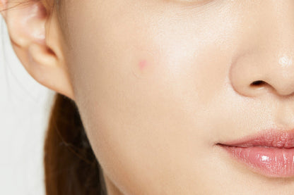 Acne Pimple Master Patch